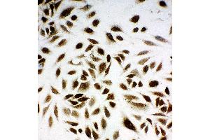 Image no. 2 for anti-Non-Metastatic Cells 1, Protein (NM23A) Expressed in (NME1) (AA 137-152), (C-Term) antibody (ABIN3044197)