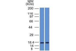 Image no. 1 for anti-Prolactin-Induced Protein (PIP) (AA 41-146) antibody (ABIN6940316)