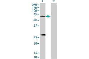 Image no. 1 for anti-Interleukin 6 Receptor (IL6R) (AA 1-468) antibody (ABIN517053)