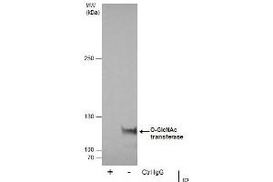 Image no. 5 for anti-O-Linked N-Acetylglucosamine (GlcNAc) Transferase (UDP-N-Acetylglucosamine:polypeptide-N-Acetylglucosaminyl Transferase) (OGT) (Center) antibody (ABIN2856718)