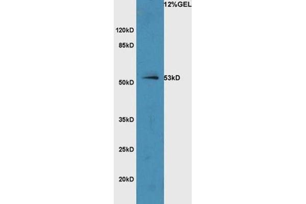 anti-Solute Carrier Family 7 (Cationic Amino Acid Transporter, Y+ System), Member 9 (SLC7A9) (AA 31-130) antibody