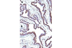 Image no. 2 for anti-F-Box Protein 5 (FBXO5) antibody (ABIN5577971)