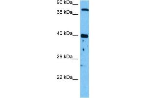 Image no. 4 for anti-Wingless-Type MMTV Integration Site Family, Member 1 (WNT1) (Middle Region) antibody (ABIN2779465)