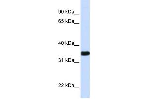 Image no. 2 for anti-Glyceraldehyde-3-Phosphate Dehydrogenase (GAPDH) (N-Term) antibody (ABIN2778645)