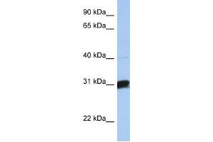 Image no. 1 for anti-UDP-Gal:betaGal beta 1,3-Galactosyltransferase Polypeptide 6 (B3GALT6) (C-Term) antibody (ABIN635815)