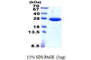 Image no. 1 for SAR1 Homolog B (SAR1B) protein (ABIN2131725)