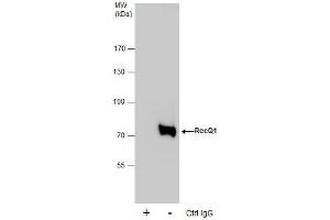 Image no. 3 for anti-RecQ Protein-Like (DNA Helicase Q1-Like) (RECQL) (C-Term) antibody (ABIN2857057)
