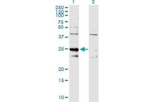 Image no. 1 for anti-Complement Component 1, Q Subcomponent Binding Protein (C1QBP) (AA 1-282) antibody (ABIN513843)