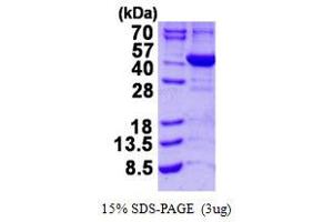 Image no. 1 for Aminolevulinate Dehydratase (ALAD) protein (His tag) (ABIN1098223)