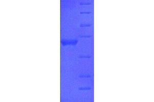 SDS-PAGE (SDS) image for Apolipoprotein A-I (APOA1) (AA 25-265), (full length) protein (His tag) (ABIN1459700)