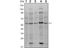Image no. 4 for anti-SMAD Family Member 4 (SMAD4) antibody (ABIN969403)