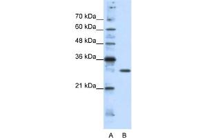 anti-Goosecoid Homeobox 2 (GSC2) (C-Term) antibody