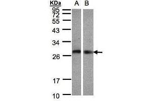 WB Image Sample(30 ug whole cell lysate) A:Hep G2 , B:Raji , 12% SDS PAGE antibody diluted at 1:1000