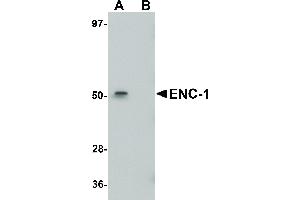 Image no. 1 for anti-Ectodermal-Neural Cortex 1 (With BTB-Like Domain) (ENC1) (Internal Region) antibody (ABIN6656824)