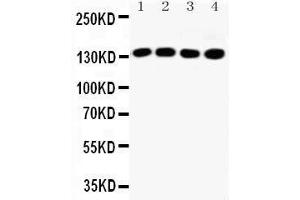 Image no. 1 for anti-Insulin Receptor Substrate 1 (IRS1) (AA 106-122), (N-Term) antibody (ABIN3042564)