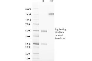 TCL1A Antikörper  (AA 2-109)