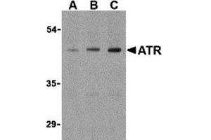 Western Blotting (WB) image for anti-ATR serine/threonine kinase (ATR) (Middle Region) antibody (ABIN1030871)