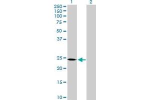 Image no. 1 for anti-Spermatogenesis and Oogenesis Specific Basic Helix-Loop-Helix 2 (SOHLH2) (AA 1-225) antibody (ABIN527261)