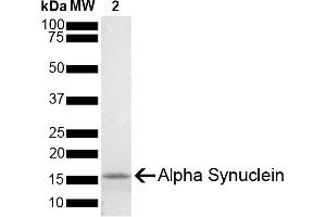 SDS-PAGE (SDS) image for Synuclein, alpha (SNCA) (full length) (Active) protein (ABIN5651242)