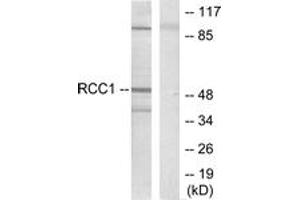 Image no. 1 for anti-Retinoic Acid Receptor, beta (RARB) (AA 331-380) antibody (ABIN1533391)