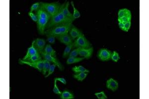 Immunofluorescence staining of HepG2 cells with ABIN7164836 at 1:100, counter-stained with DAPI.