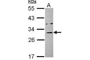 Image no. 1 for anti-Ankyrin Repeat and Sterile alpha Motif Domain Containing 1B (ANKS1B) (Center) antibody (ABIN2856291)