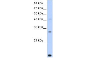 Image no. 1 for anti-CCR4-NOT Transcription Complex, Subunit 7 (CNOT7) (N-Term) antibody (ABIN2780900)
