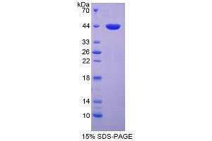 Image no. 1 for Lipocalin 12 (LCN12) protein (ABIN3010496)