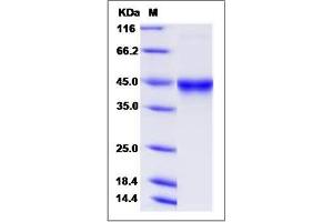Image no. 1 for Interleukin 5 Receptor, alpha (IL5RA) (AA 1-328) (Active) protein (His tag) (ABIN2008711)