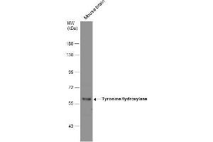 Image no. 2 for anti-Tyrosine Hydroxylase (TH) (Center) antibody (ABIN2855393)