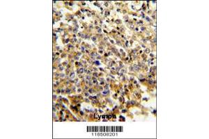 Image no. 2 for anti-Neutrophil Cytosolic Factor 4, 40kDa (NCF4) (AA 260-289), (C-Term) antibody (ABIN391905)