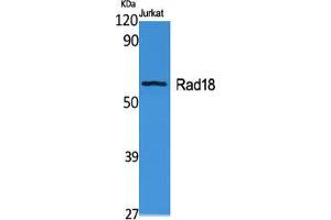 Image no. 2 for anti-E3 ubiquitin-protein ligase RAD18 (RAD18) (Internal Region) antibody (ABIN3186652)