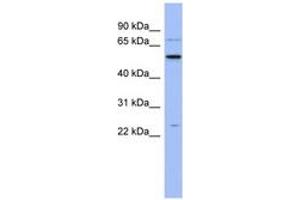 Image no. 1 for anti-Zinc Finger CCHC-Type and RNA Binding Motif 1 (ZCRB1) (N-Term) antibody (ABIN6743039)