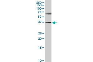 Image no. 1 for anti-Sulfotransferase Family 1E Member 1 (SULT1E1) (AA 1-294) antibody (ABIN520564)