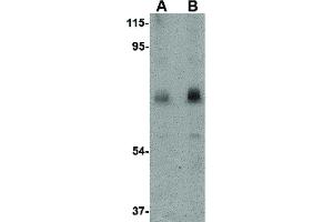 Image no. 2 for anti-Calpain 6 (CAPN6) (C-Term) antibody (ABIN6656158)
