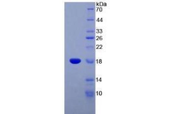 Somatostatin Protein (SST)