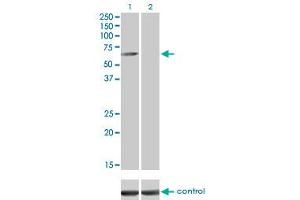 Image no. 2 for anti-Calcium/calmodulin-Dependent Protein Kinase Kinase 1, alpha (CAMKK1) (AA 1-520) antibody (ABIN566554)