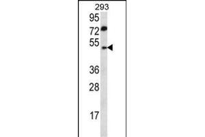ABHD2 antibody  (AA 263-292)