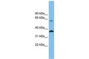 Image no. 1 for anti-Solute Carrier Family 25 (Mitochondrial Carrier, Adenine Nucleotide Translocator), Member 4 (SLC25A4) (AA 35-84) antibody (ABIN6744751)