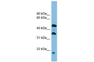 Image no. 1 for anti-Chromosome 11 Open Reading Frame 73 (C11orf73) (Middle Region) antibody (ABIN632611)