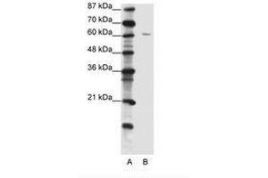 Image no. 1 for anti-Zinc Finger Protein 268A (ZNF286A) (C-Term) antibody (ABIN202711)