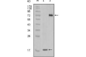Image no. 3 for anti-serine/threonine/tyrosine Kinase 1 (STYK1) antibody (ABIN969425)