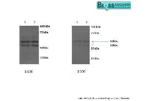 SCARB1 Antikörper  (AA 21-100)