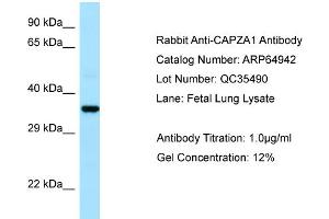 Image no. 1 for anti-Capping Protein (Actin Filament) Muscle Z-Line, alpha 1 (CAPZA1) (N-Term) antibody (ABIN2790001)