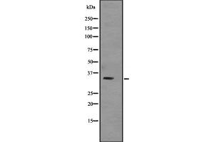 TNNT3 anticorps  (C-Term)