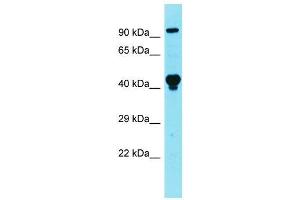 Image no. 1 for anti-La Ribonucleoprotein Domain Family, Member 4B (LARP4B) (Middle Region) antibody (ABIN2779079)
