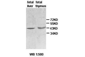 Western blot analysis of fetal liver and thymus lysate, using ACTBL2 antibody.