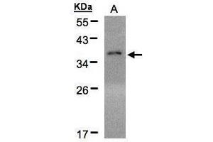 Image no. 1 for anti-Eukaryotic Translation Initiation Factor 2A, 65kDa (EIF2A) (Center) antibody (ABIN2854984)