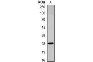 Image no. 2 for anti-serine Peptidase Inhibitor, Kunitz Type, 2 (SPINT2) (full length) antibody (ABIN6006132)