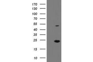 Image no. 3 for anti-Eukaryotic Translation Initiation Factor 5A2 (EIF5A2) antibody (ABIN1497996)